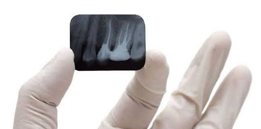 Image of Dental X-ray