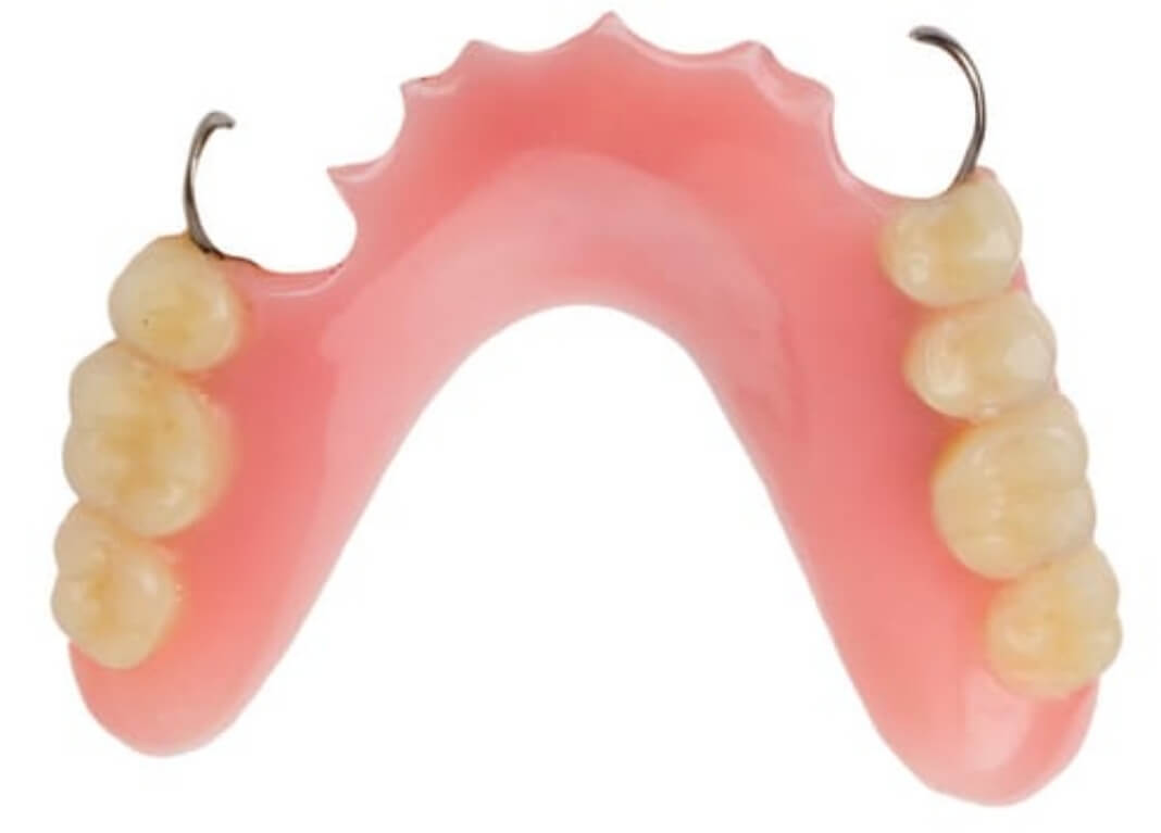 Image of partial dentures