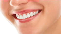 Cosmetic dentistry and smile Designing