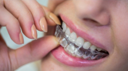 Orthodontic treatments, invisible braces & Invisalign